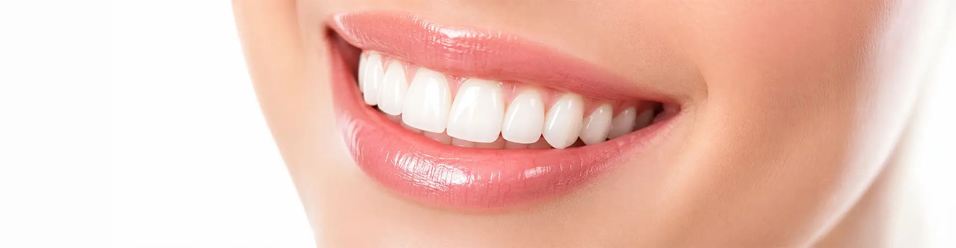 Composite Bonding