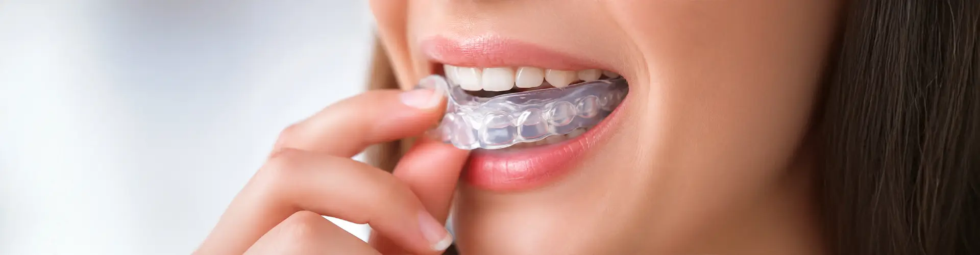 Mouth Guards