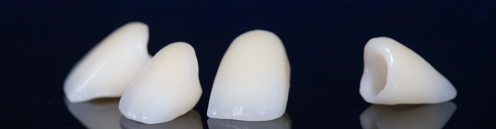 Porcelain Dental Veneers