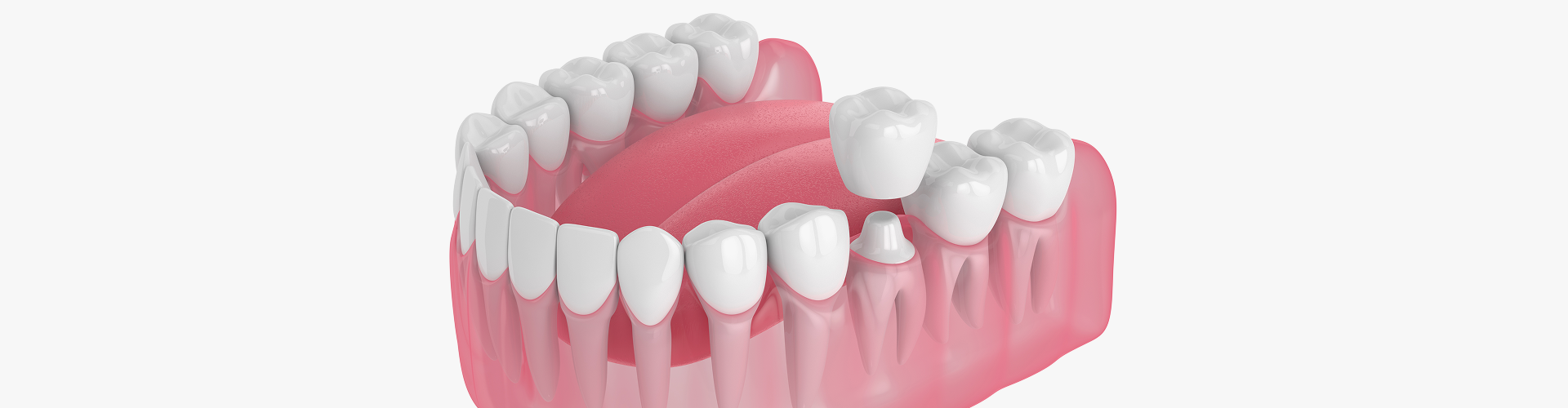 Restorative Dentistry