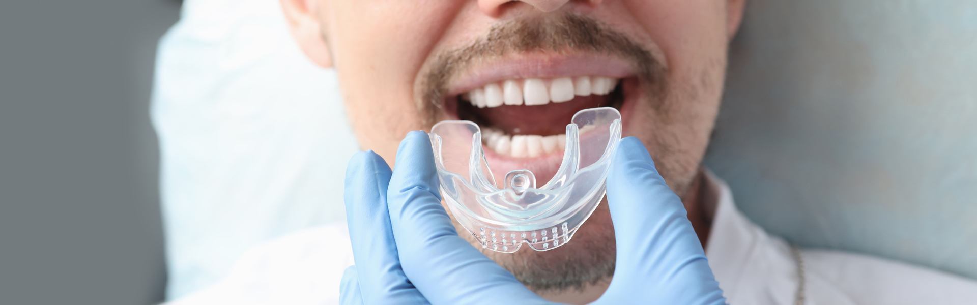 Mouthguards