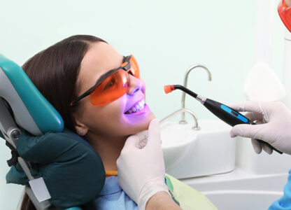 How Long Does Dental Bonding Last on Back Teeth?