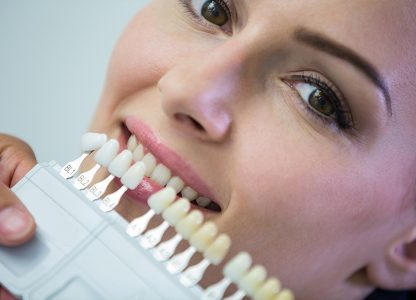 Top Benefits of Dental Veneers for a Perfect Smile
